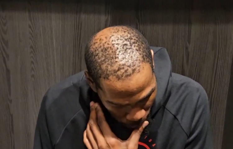 开云体育-37岁还单身有原因😳！杜兰特秃顶这么严重 这发量找对象难啊